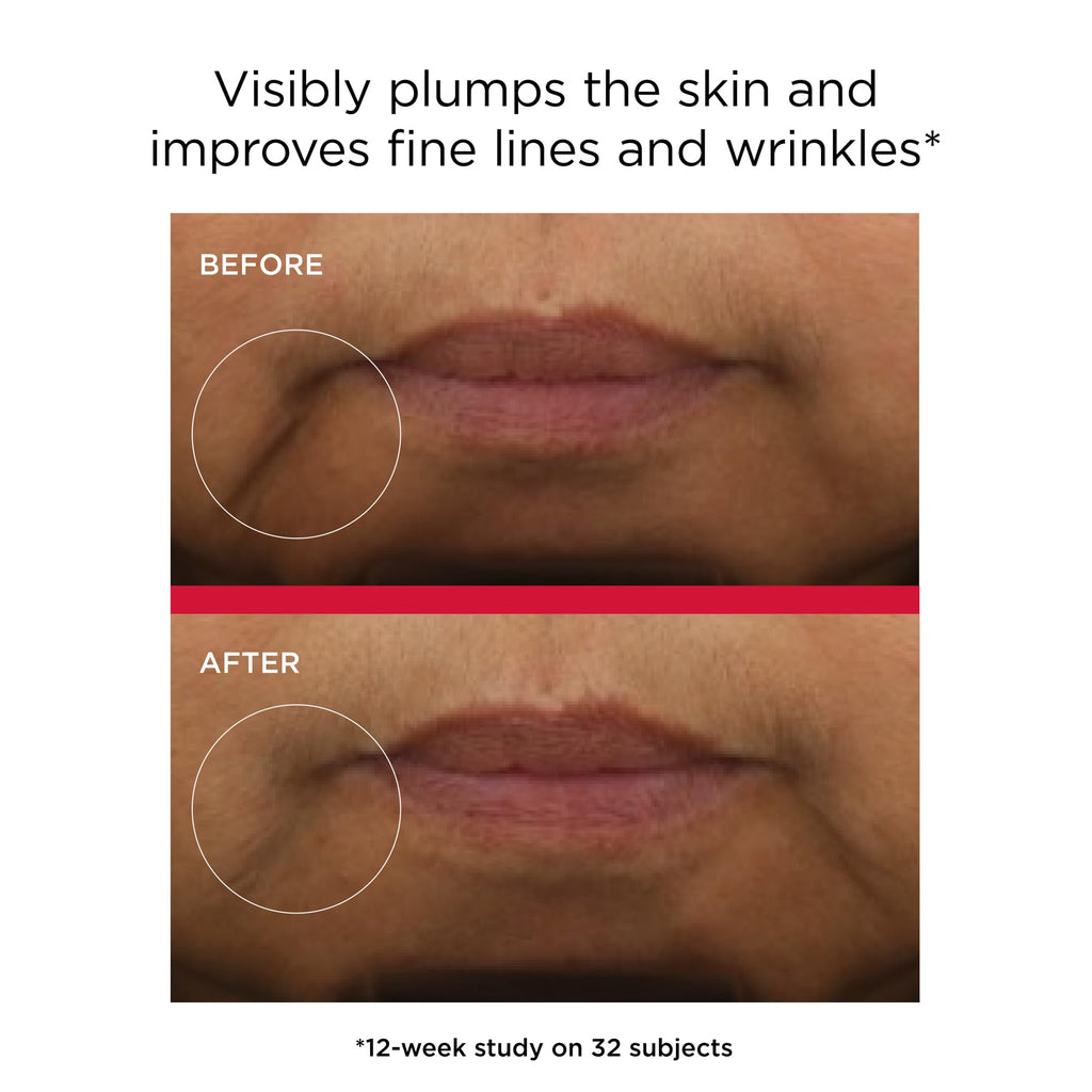 EltaMD UV Daily Hydration+ SPF 50 – Lightweight Sunscreen for Advanced Sun Protection & Skin Hydration.