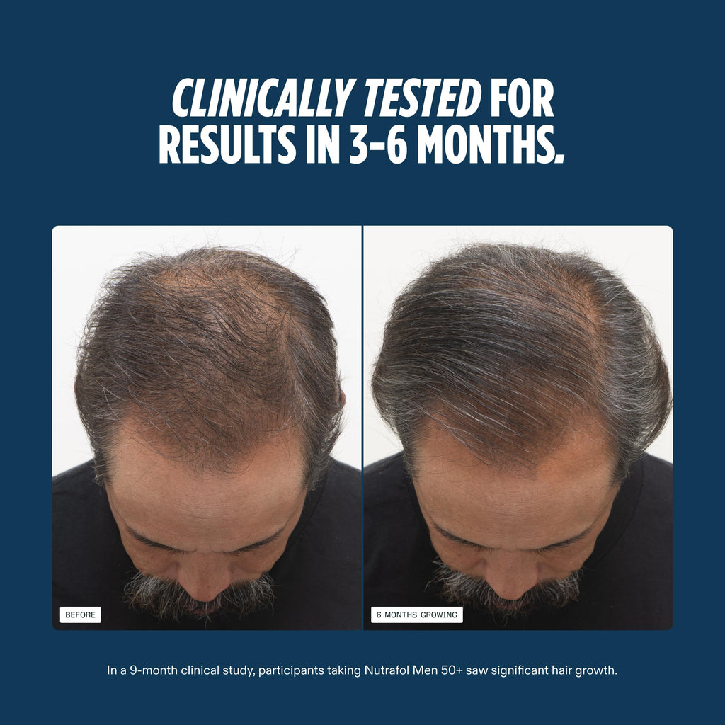 Nutrafol Men 50+ Hair Growth Supplements – Clinically Tested for Thicker Hair & Scalp Coverage.